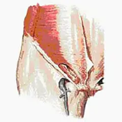 Illustration anatomique montrant le muscle pectiné, source potentielle de douleur chez la femme.