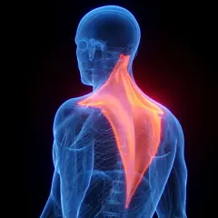 Vue anatomique du dos humain, mettant en évidence les muscles trapèzes en rouge vif, symbolisant la douleur trapeze.