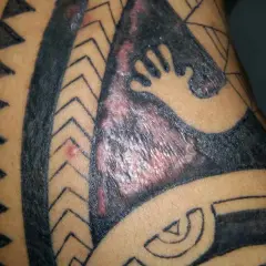 Gros plan sur un tatouage tribal qui gratte, avec des zones rouges et enflammées sur la peau.