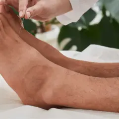 Une aiguille d'acupuncture est insérée sur le dessus du pied, ciblant un point d'acupuncture lié à l'estomac.