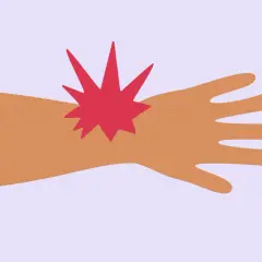 Bras avec une étoile rouge symbolisant un nerf cervical coincé symptôme.
