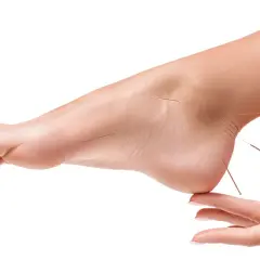 Acupuncture sur le pied pour soulager la douleur. Des aiguilles fines sont insérées sur le dessus et le talon du pied.