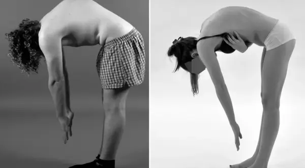 Deux individus se penchent en avant. L'image A montre une cyphose dorsale normale chez un homme. L'image B montre une posture similaire chez une femme.