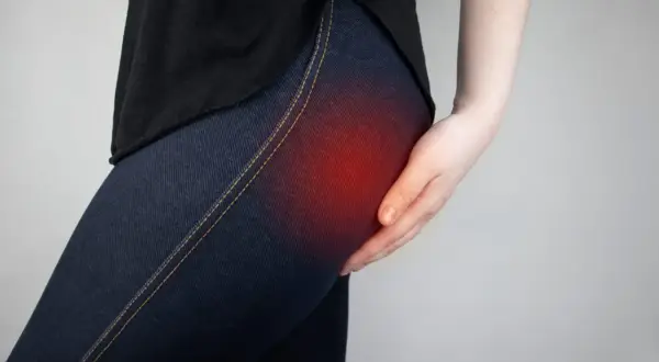 Une main touche la hanche, une zone rouge indiquant une douleur liée au syndrome fessier profond.