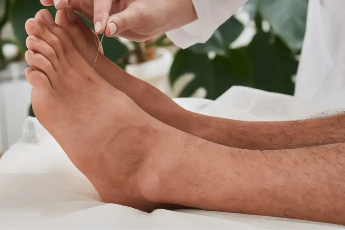 Une aiguille d'acupuncture est insérée sur le dessus du pied, ciblant un point d'acupuncture lié à l'estomac.