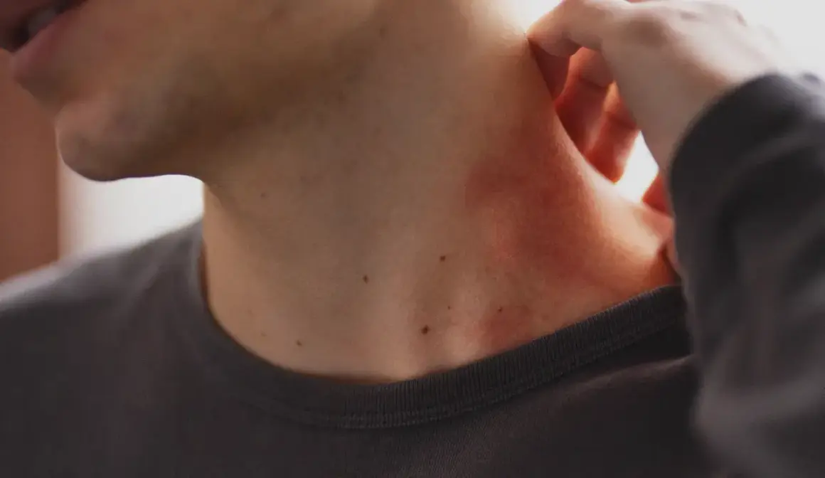 Une zone de peau rouge, peut-être une vergeture rouge, apparaît sur le cou d'une personne qui se gratte.
