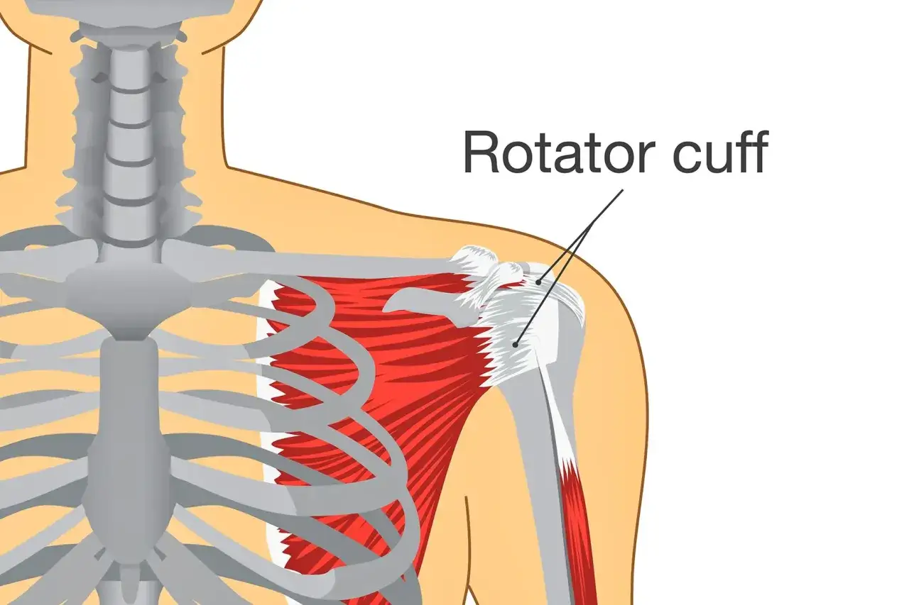 Anatomie de l'épaule montrant la coiffe des rotateurs. Une traction peut causer une douleur à l'épaule.