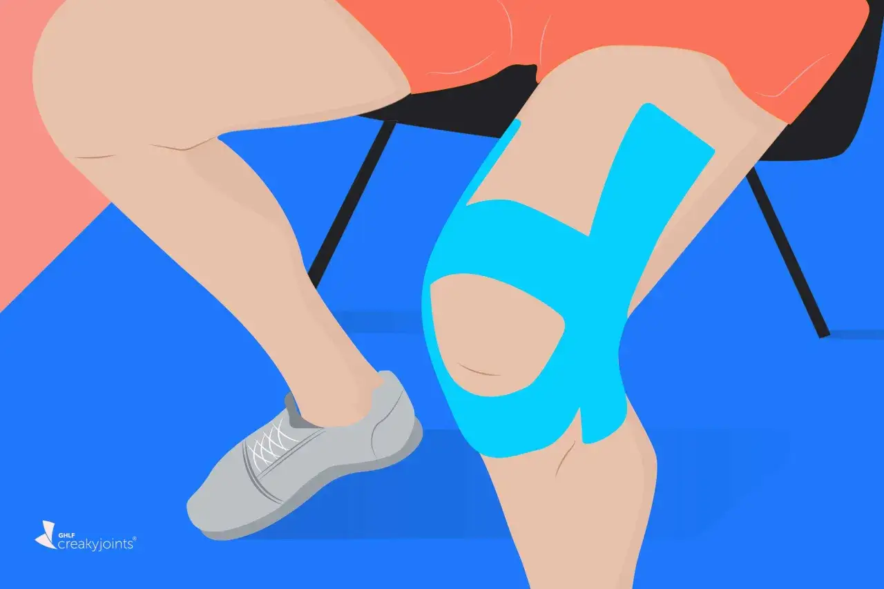 Genou avec taping bleu pour soulager l'arthrose. Jambe en mouvement, chaussure grise.