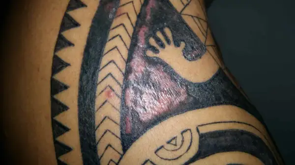 Gros plan sur un tatouage tribal qui gratte, avec des zones rouges et enflammées sur la peau.