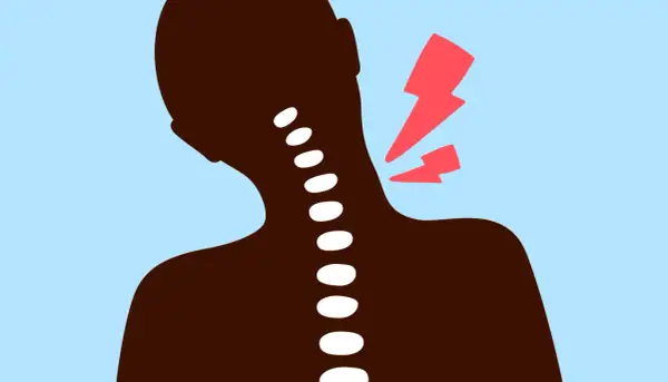 Silhouette d'une personne avec une colonne vertébrale visible, symbolisant une nuque bloquée et une douleur vive.